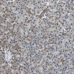NDUFB5 Antibody, Novus Biologicals:Antibodies:Primary Antibodies